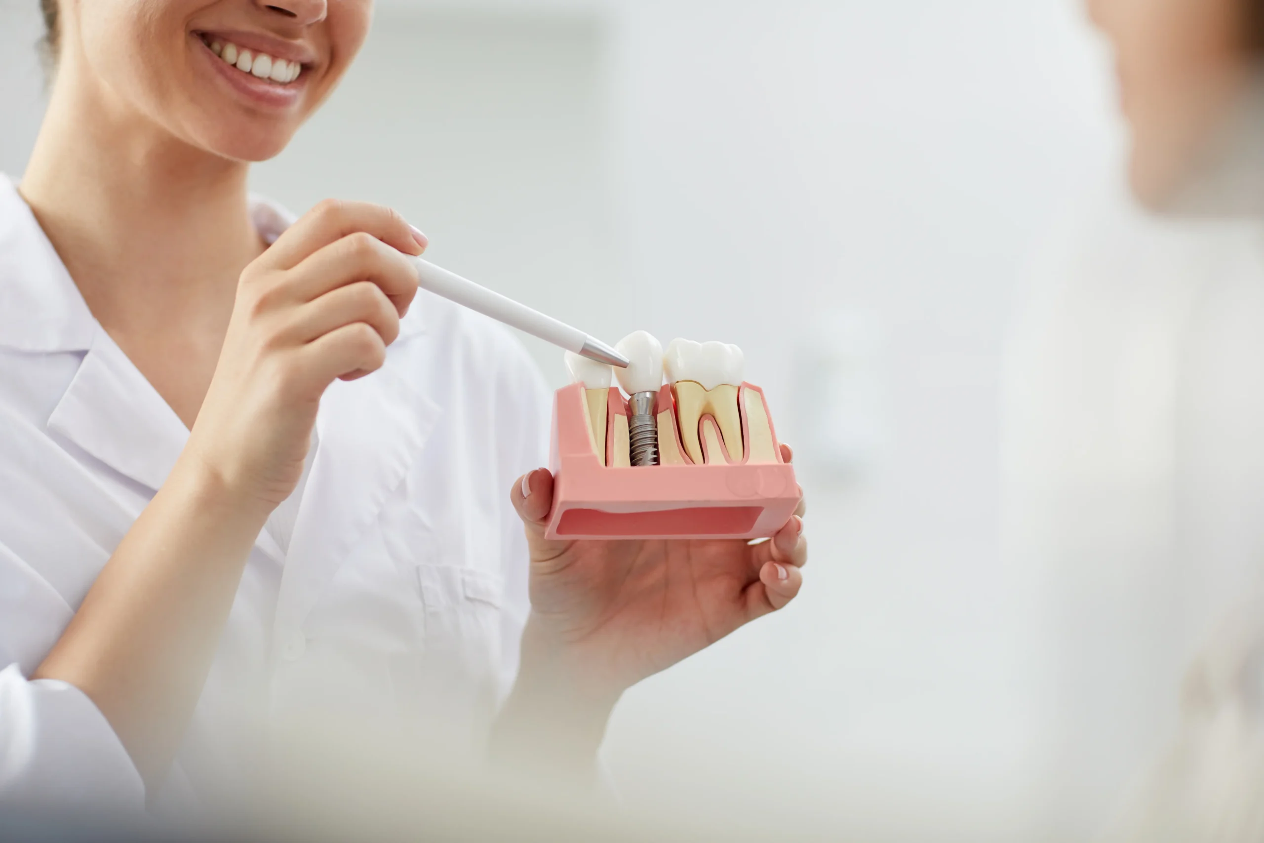 Dental
Implants