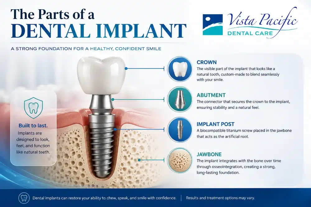 Educational infographic about Dental Implants in Oxnard, CA showing the crown, abutment, implant post, and jawbone and how these components work together in a dental implant restoration