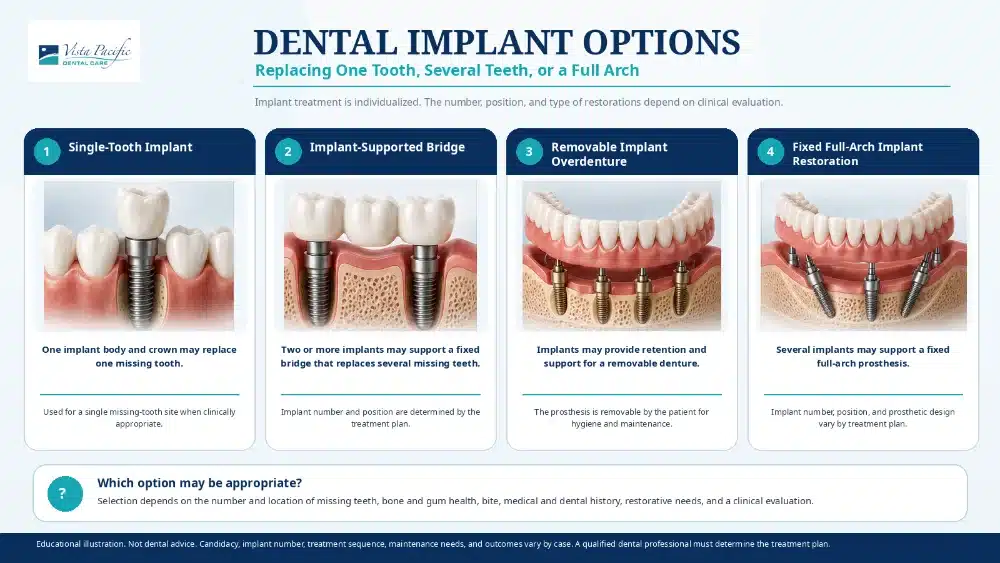 Educational infographic about Dental Implants in Oxnard, CA comparing single-tooth implants, implant-supported bridges, removable implant overdentures, and fixed full-arch implant restorations for different missing-tooth needs